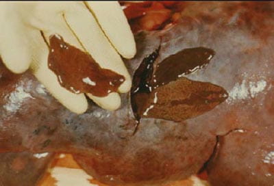 Deer Liver Fluke