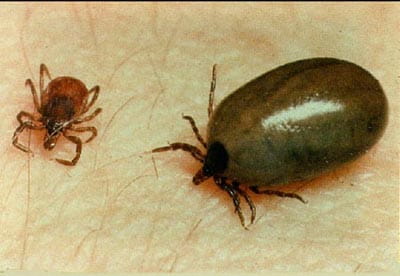 ticks (the tick on the right is engorged with blood) ticks (the tick on the right is engorged with blood)