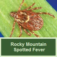 Rocky Mountain Spotted Fever