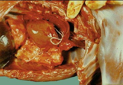 heartworm parasite heartworm parasite