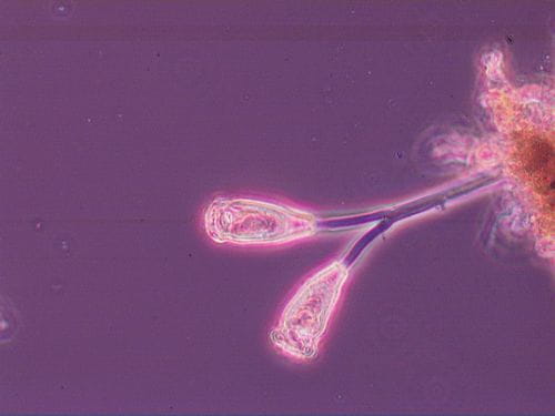 Stalked Ciliate Zoothamnium 10X